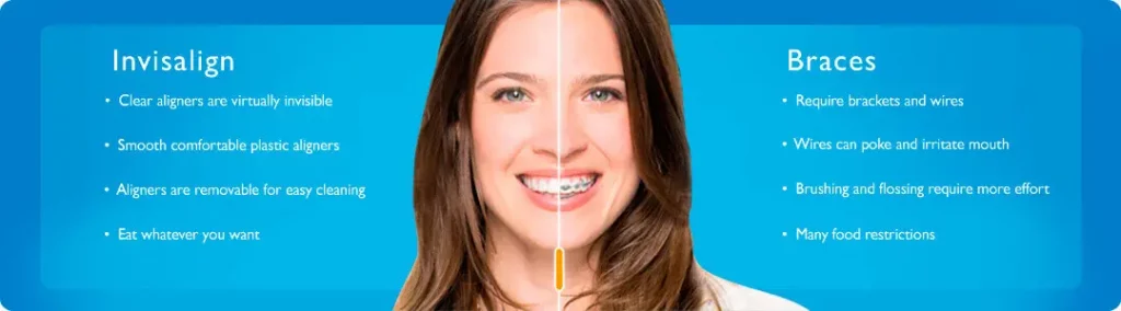 Invisible Braces for Adults in Boston